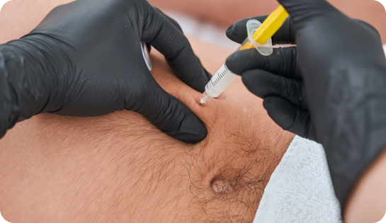 treatment img